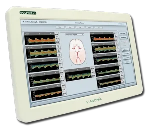 Dolphin 4D transcranial Doppler system